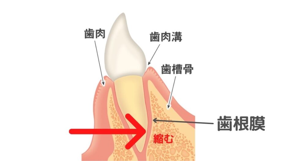 矯正の仕組み・歯槽骨の図