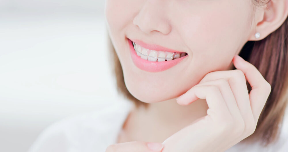 歯列矯正後に装着する「リテーナー」｜使用目的・使用期間・種類、使用するときの注意点を解説