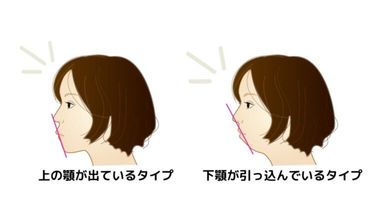 歯が緑色になる外的理由